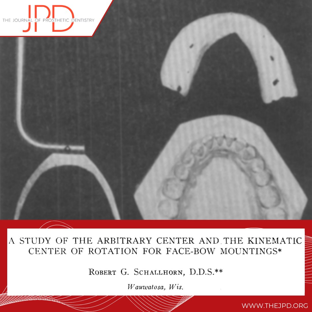 JPDentistry's tweet image. Learn more from this classic article about the advantages and disadvantages of using an average axis (arbitrary) vs. a kinematic (fully adjustable) #facebow to relate the maxillary cast to the condylar elements of an articulator: thejpd.org/article/0022-3…