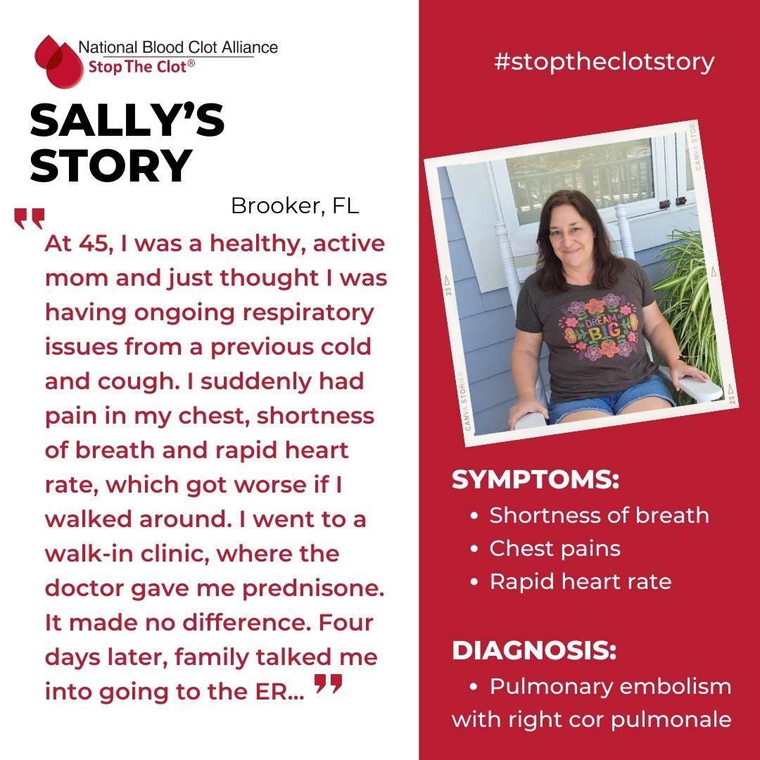 StopTheClot's tweet photo. "After blood tests & a CT scan, I was told I had saddle #pulmonaryemboli & #rightcorpulmonale, a condition that causes the right side of the heart to fail." Sally's story: https://t.co/cLpneQwVW0
#stoptheclot #stoptheclotstory #bloodclots #thrombectomy https://t.co/nIwGnYFbd1