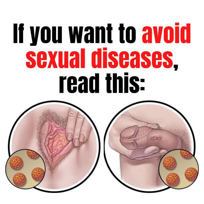 walanthonio's tweet image. 