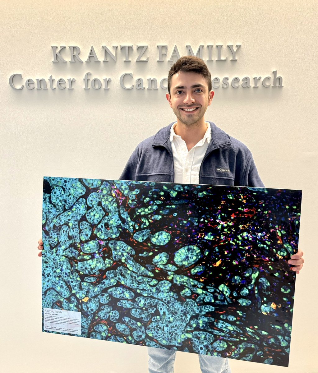 Congratulations to Dr. Daniel Ruiz Torres @druiztorres_ for winning FIRST place in the @MGH_RI Image Competition! 🎉🍾 Daniel is holding his winning image, entitled ‘A Living Puzzle’. It is a 🔬image of a head and neck tumor, stained to reveal important cell-cell interactions.