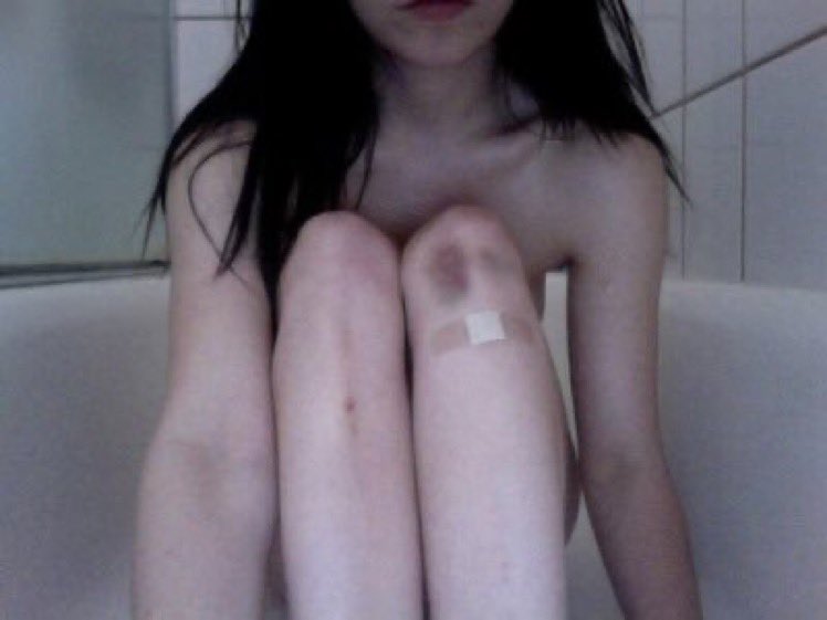 lucaacal's tweet photo. I TRIEDDDD (i’ve always loved this pic and now i finally have some bruises i tried to recreate it ehe) https://t.co/VW0MPUVgoW