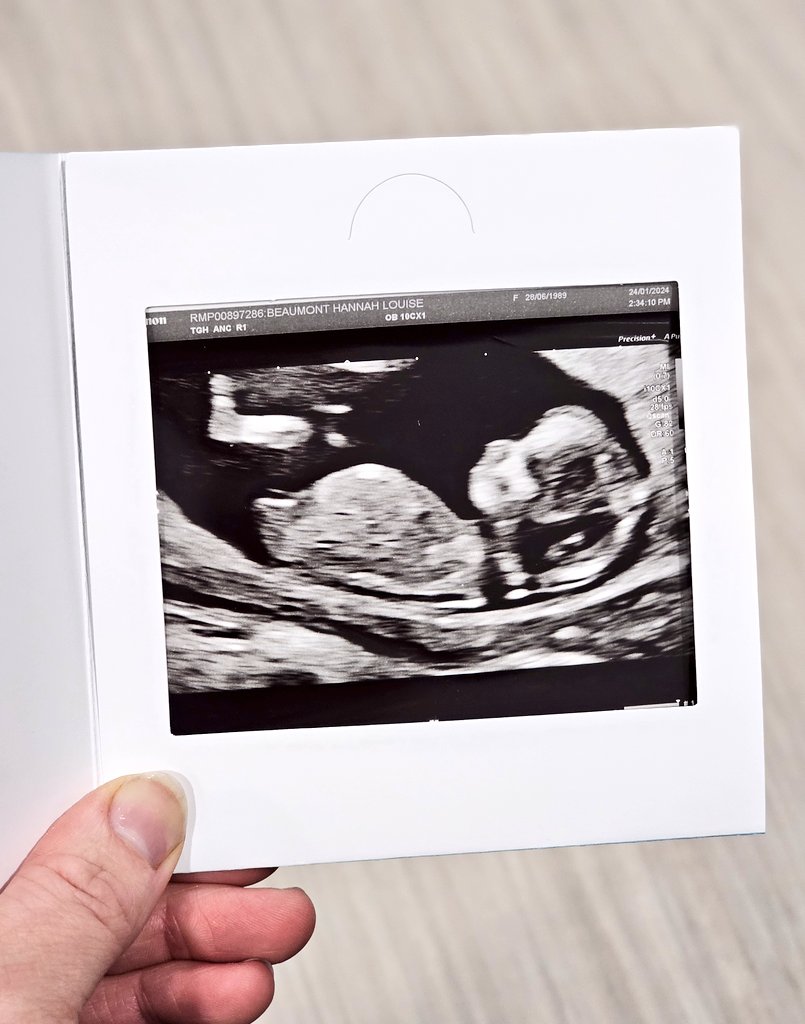 hanbeau3's tweet photo. I can't wait for August 5th to meet our little one 🥰🤍 @antmalc 3 months down, 6 more to go! 🥹👨‍👩‍👧 https://t.co/MQA3kOzFCr