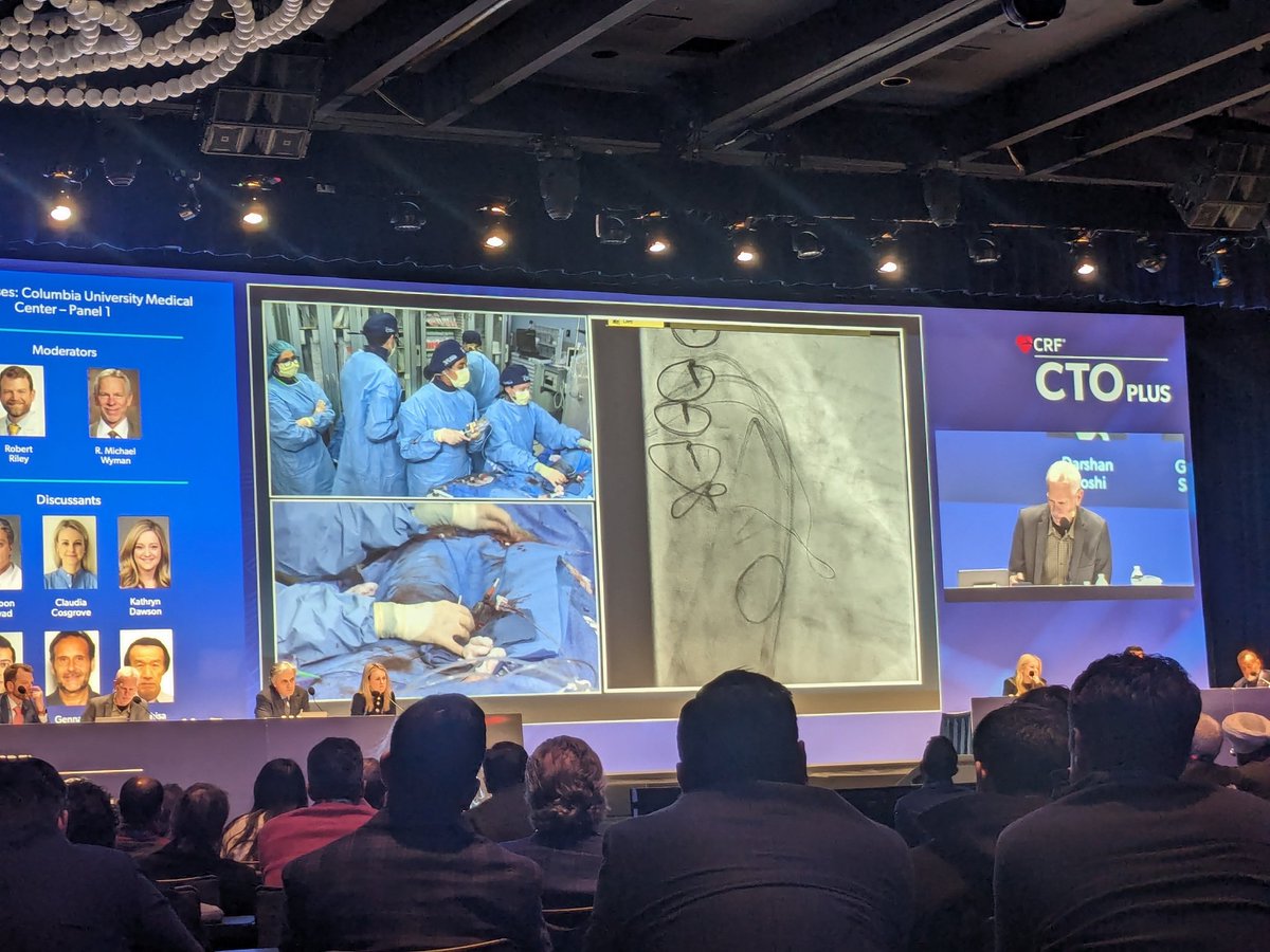 Live case session this afternoon. Three great cases. @mbmcentegart @KateKearney4 and @SanjogKalra demonstrating solutions for addressing calcification, tortuosity and vessel ambiguity. #CTO2024 @DKarmpaliotis @kjkunkelmd @DrAmirKaki @KAlaswadMD @DrDarshanDoshi