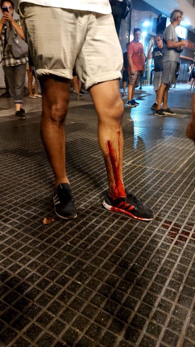 Ngperio's tweet photo. Este jueves las fuerzas de seguridad amedrentaron con balas de goma y gas lacrimógeno a más de 30 trabajadores de prensa en la represión en las inmediaciones del Congreso. Como comunicadores nos preocupa que en plena democracia se atente contra la libertad de expresión 👇 https://t.co/KHcLCxQ7yP