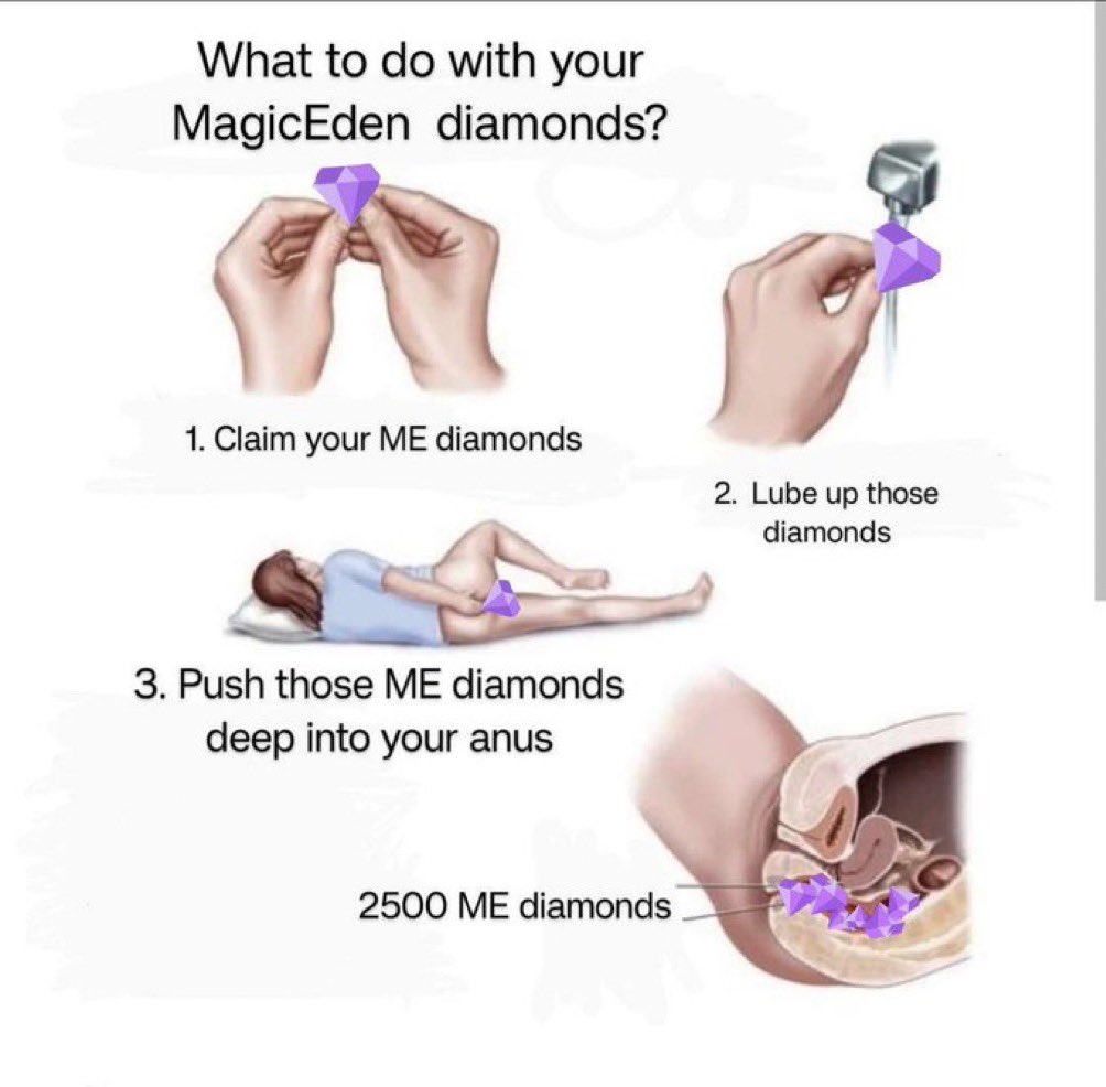 In case anyone needs clarification on the utility of the @MagicEden diamonds 🤝 💪 👇