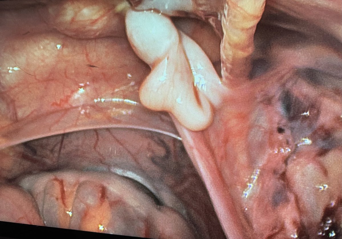 Luis Braga tweet media