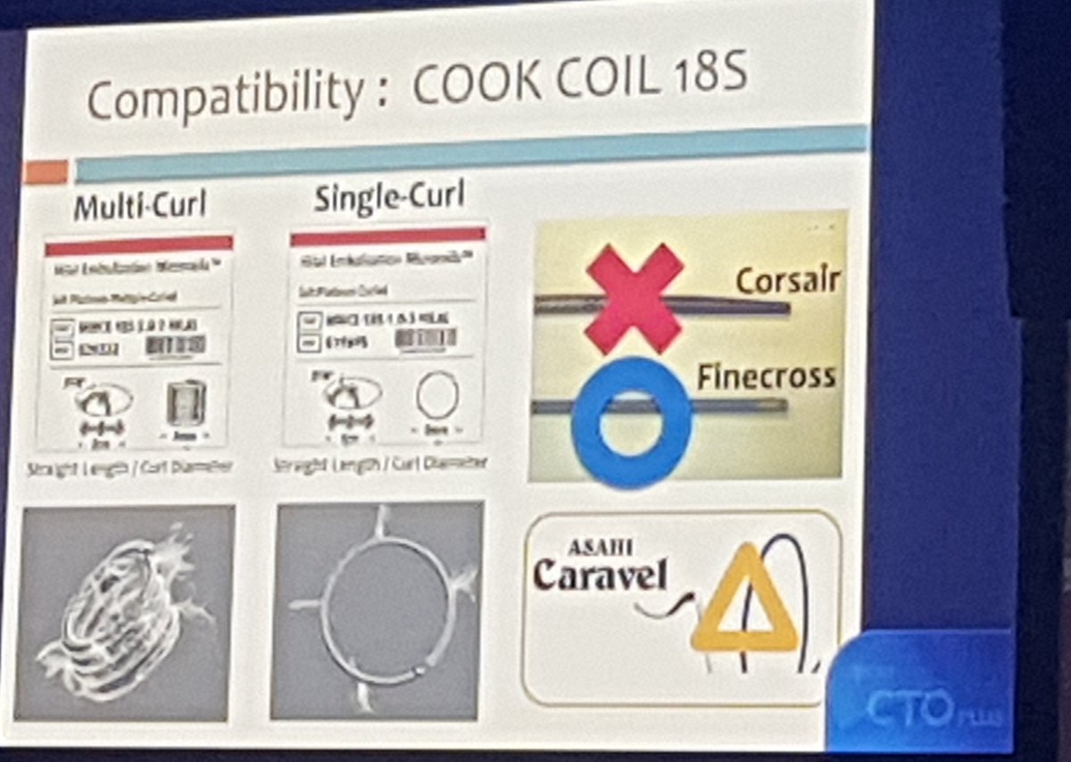 Great tips for coiling type 5 coronary perfs. Note hand position. Normal wire can be used.
If coil rip curls up it's out of vessel- that's when you pull back your finecross. 
Goal is to have small coiled part outside, rest (straight )in vessel.

#CTO2024