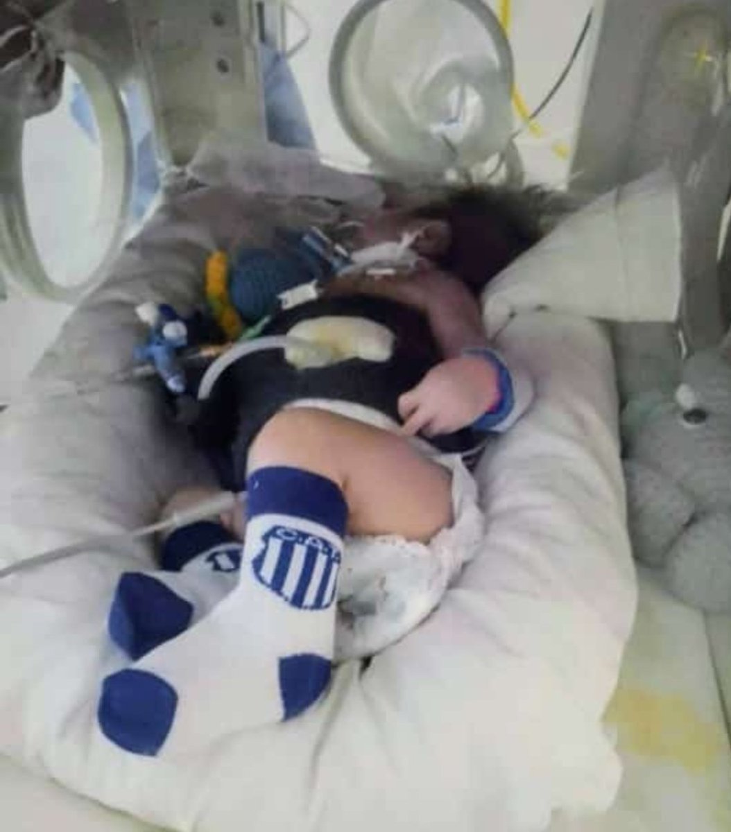 LaHoyonetaRip's tweet image. COLECTA SOLIDARIA POR BRUNO.

Bruno nació con malformaciones genéticas. Desde los 15 días se encuentra con traqueo y botón gástrico. Él, necesita un estudio genético llamado "MICRO ARRAY", el cuál la Obra Social APROSS no se la cubre.  Ayudemos entre todos❤️