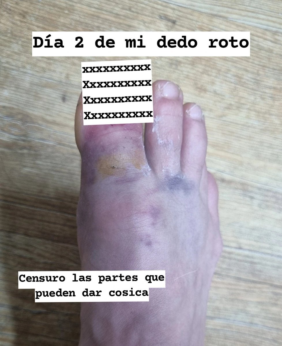 Ireko Fitness tweet media