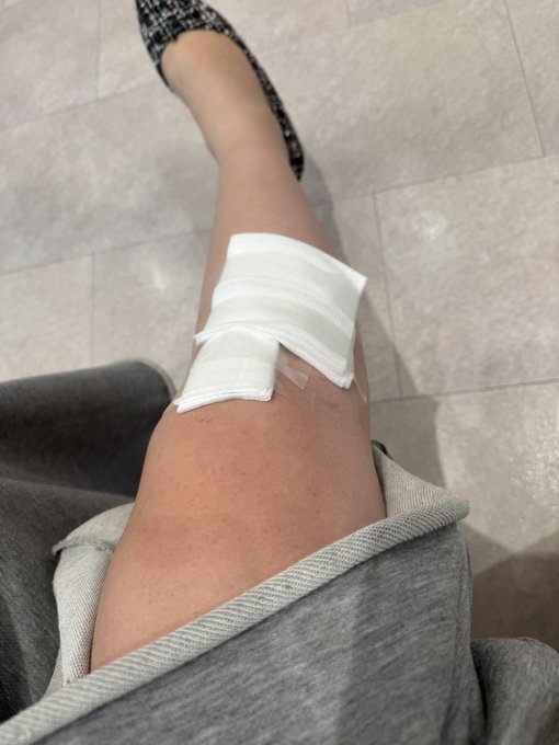 ちゃんと病院行ってきたよー😩 皆様の心配のコメントは全部読ませていただいてます❤︎心より感謝🥲 https://t.co/RFuquEg9V8