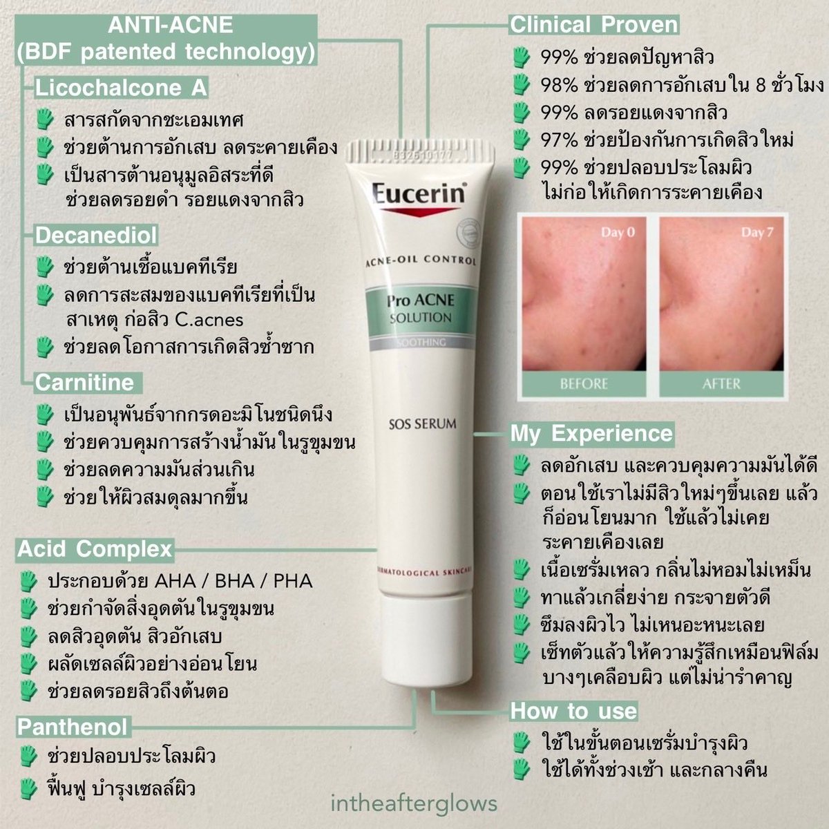 ใครที่มีปัญหาสิวซ้ำซาก ไม่หายซักที หรือมีรอยสิวแล้วอยากจัดการ คือไปลองเซรั่มจบสิวตัวใหม่ของ Eucerin SOS Serum💥 ที่เจ๋งจริงทั้งส่วนผสม เท็กเจอร์และผลลัพธ์ คือเพิ่งได้ลองเหมือนกันและพบว่ามันดีจริง! 
#EucerinThailand
#EucerinSOSserum #จบทุกสิวซ้ำซากใน7วัน