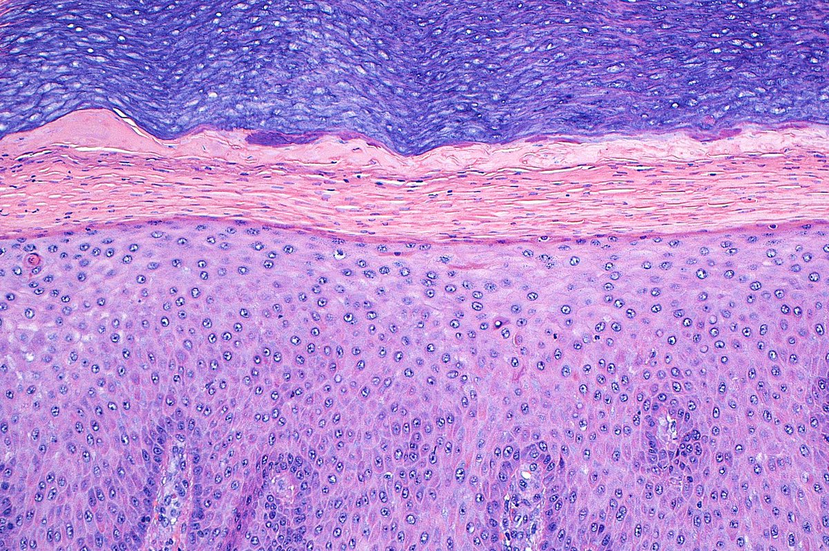 Stratum Lucidum ~ #PathArt