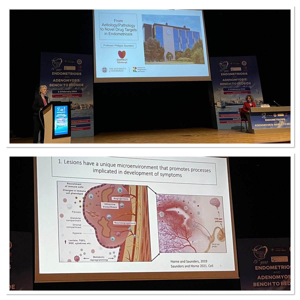 Andrew Horne (@horne_research) on Twitter photo <a href="/p_saunder/">Philippa Saunders</a> follows with wonderful overview of future novel therapeutic targets for #endometriosis <a href="/exppect/">EXPPECT Edinburgh</a> <a href="/EdinUni_CRH/">The Centre for Reproductive Health</a> <a href="/EdinUni_IRR/">Institute for Regeneration and Repair</a> <a href="/EdinUniMedicine/">Edinburgh Medical School</a> @endometriosistr <a href="/drenginoral/">Prof. Dr. Engin Oral</a> <a href="/firsttouchgames/">First Touch Games</a> <a href="/fitfindik/">Fitnat Topbas Selcuki MD</a> <a href="/p_saunder/">Philippa Saunders</a> follows with wonderful overview of future novel therapeutic targets for #endometriosis <a href="/exppect/">EXPPECT Edinburgh</a> <a href="/EdinUni_CRH/">The Centre for Reproductive Health</a> <a href="/EdinUni_IRR/">Institute for Regeneration and Repair</a> <a href="/EdinUniMedicine/">Edinburgh Medical School</a> @endometriosistr <a href="/drenginoral/">Prof. Dr. Engin Oral</a> <a href="/firsttouchgames/">First Touch Games</a> <a href="/fitfindik/">Fitnat Topbas Selcuki MD</a>
