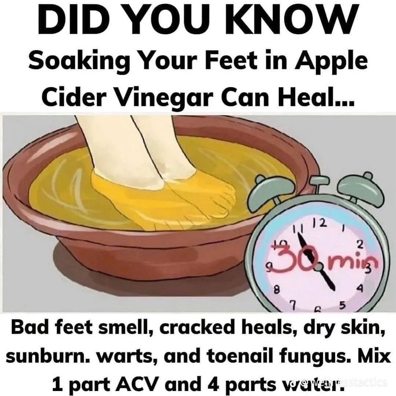 Organic Live Food on X: Soaking your feet in apple cider vinegar can heal  smelly feet, cracked heels, dry skin, sunburn, warts, and toenail fungus   / X