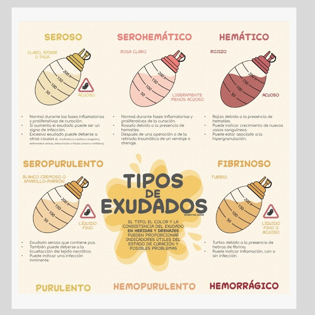 El #exudado se refiere a un líquido que se acumula en un área del cuerpo.El análisis de este fluido puede proporcionar información clínica importante para el diagnóstico y tratamiento de diversas enfermedades.
Infografía @enfermeriacreativa
  #formacionsanitaria