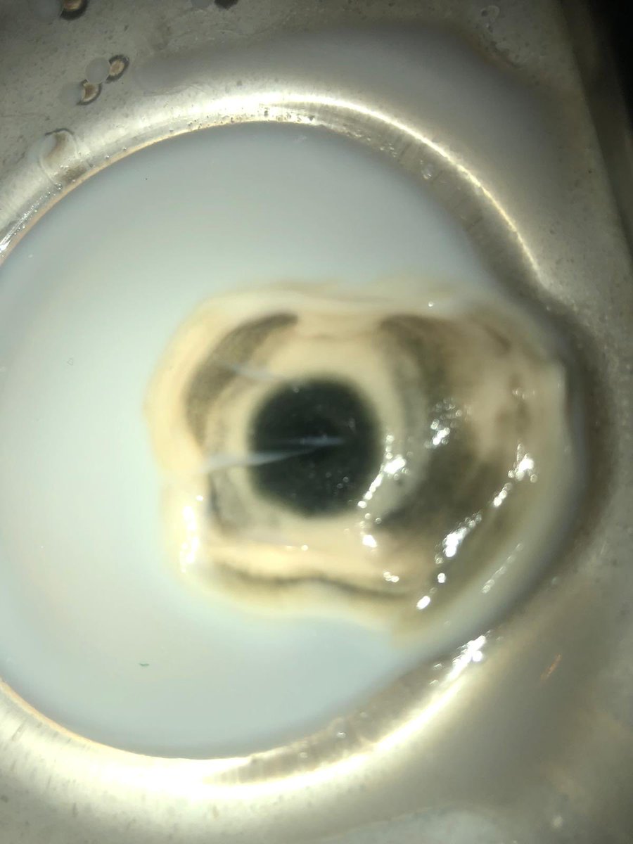 ⁦<a href="/Ulker/">Ülker</a>⁩ ⁦<a href="/icim/">İçim</a>⁩ 3 gün önce aldığım sütten çıkan şey… Açıklama yapmak ister misiniz nedir bu? ⁦