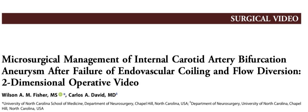 DocCDavid's tweet photo. Hot off the presses- bypass and clipping of large ICA bif aneurysm having failed coil and flow diversion 
https://t.co/6zaGXxOQ5k
@UNCneurosurgery @cvsection @svinsociety @neurosurgatlas @NeurosurgeryCNS @TarheelToughies https://t.co/8PSSt7h433