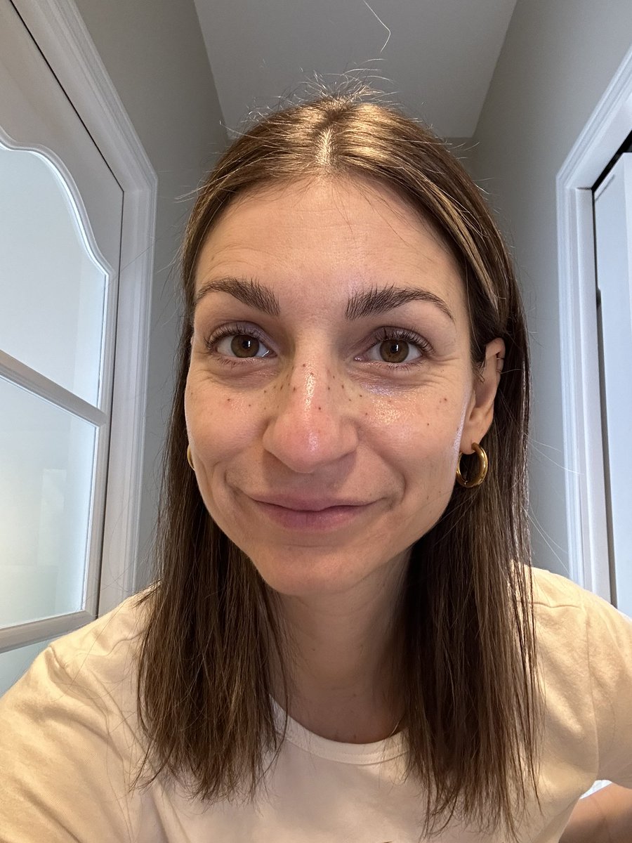 JamieVeronique's tweet photo. The redness is almost gone, but the color didn’t fade yet. I’m starting to worry! #frecklestattoo #Day3 https://t.co/qPrzv8ZZ4R