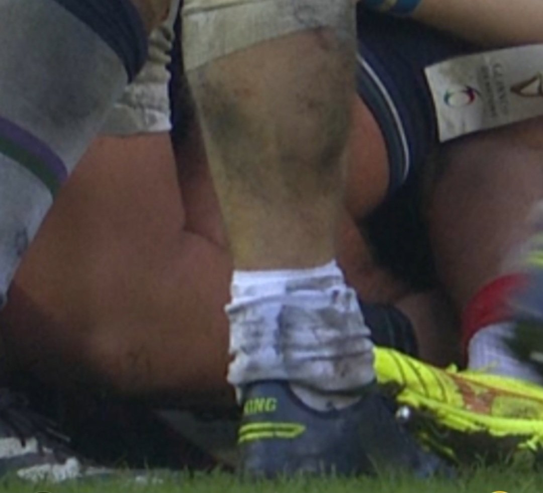 That looks a lot like the ball is on the grass 

#SCOvFRA