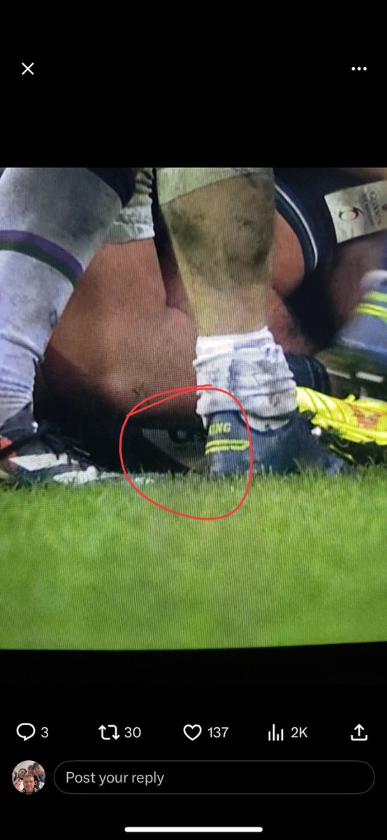 Nutbutlover's tweet photo. @lifeisgood003 @Kris10collie @Scotlandteam There’s your evidence https://t.co/gCfK96y2nA