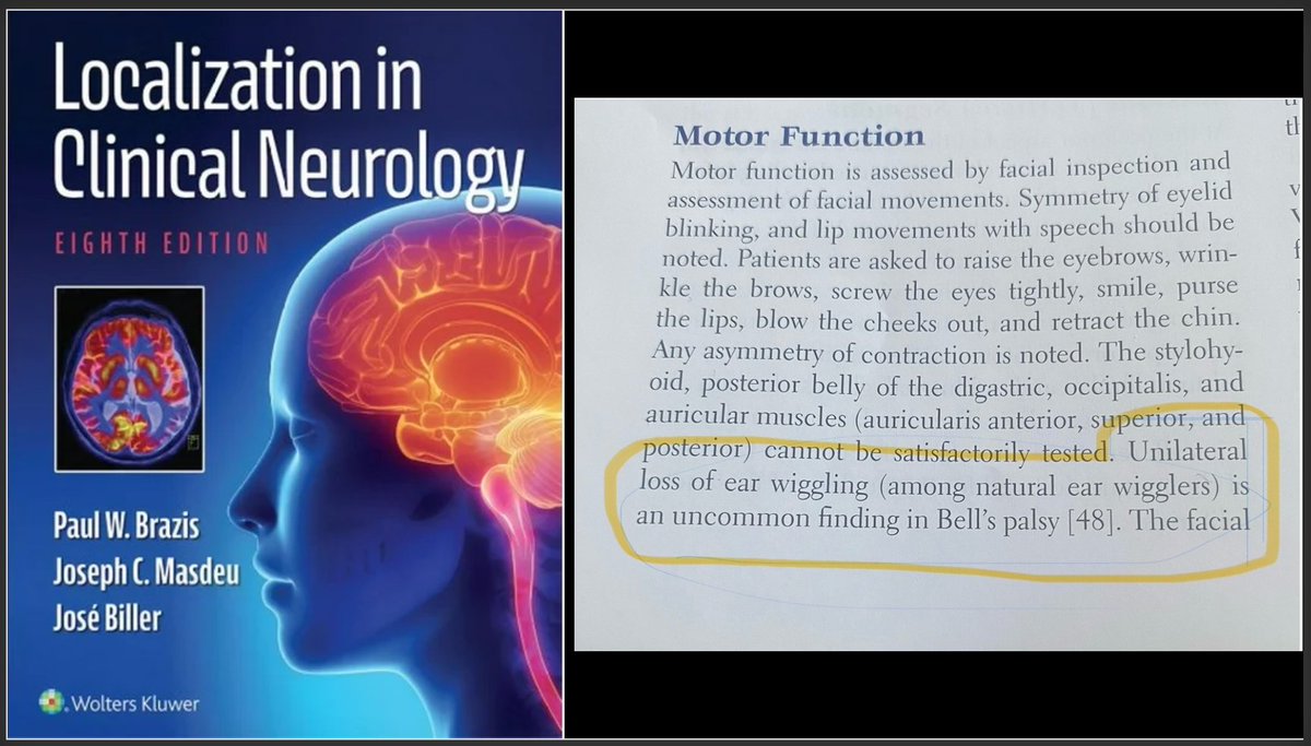 Does anyone have a favorite line a textbook?

This one is solid gold: 'Unilateral loss of ear wiggling among natural ear wigglers is an uncommon finding in Bell's palsy.' Brazis, et al. #neurotwitter