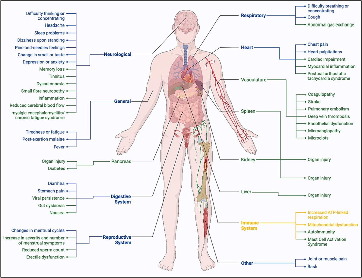 No, #LongCovid (PASC) is real! Now, a new, cellular level study has also proved that! The study finds that altered mitochondrial respiration in peripheral blood mononuclear cells of LongCovid patients may be contributing to the etiology of PASC. 1/