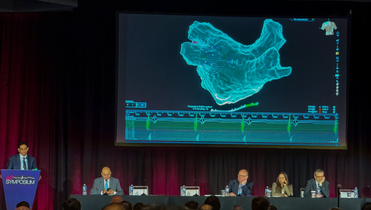 Dr. <a href="/PrashSanders/">Prash Sanders</a> just completed a live case at #AFSymposium2024 this morning with our next generation Volt PFA System. Great to see this technology in action.  

#Abbottproud #EPeeps
