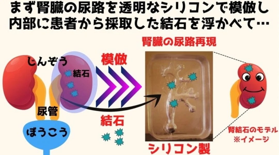 tyomateee's tweet photo. ビッグサンダーマウンテンに腎臓結石を排出させる効果があるという話、特に後部座席でその効果が高く、60回の乗車で約64%排石したという、これは初めて知った… https://t.co/XrBpVmEU6k