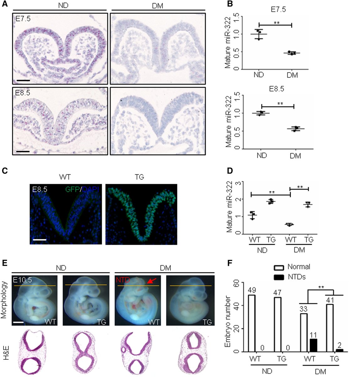 AJOG_thegray's tweet photo. MicroRNA-322 overexpression reduces neural tube defects in diabetic pregnancies - miR-322 is required for neurulation https://t.co/ypl9ddyy9M https://t.co/8GmLURkSHE