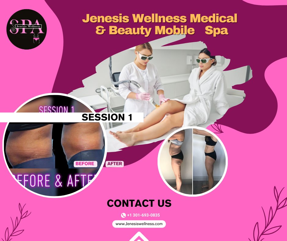 Angel93006's tweet photo. "Discover a new you with our non-invasive body reshaping techniques at Jenesis Wellness Spa.
#weight
#weightlose
#emszero
#emsculpt
#coolsculpt
https://t.co/oZsLHXQ6ZP
Cell # +1 301-693-0835
📍Location, Washington is located near Tantallon, Washington DC https://t.co/H1IZoYyODm