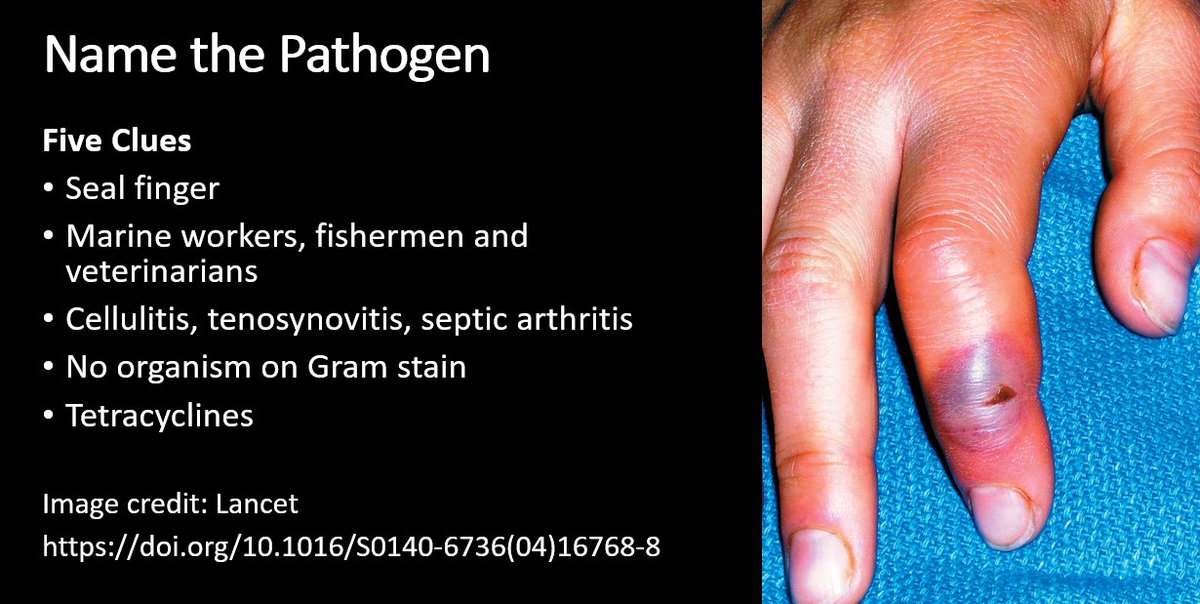 MayoClinicINFD's tweet photo. Weekend Digest

Name the Pathogen
Five clues
1. Seal finger
2. Fishermen
3. Tenosynovitis and septic arthritis
4. NO organism on Gram stain
5. Tetracyclines https://t.co/5lXUCYXrr7