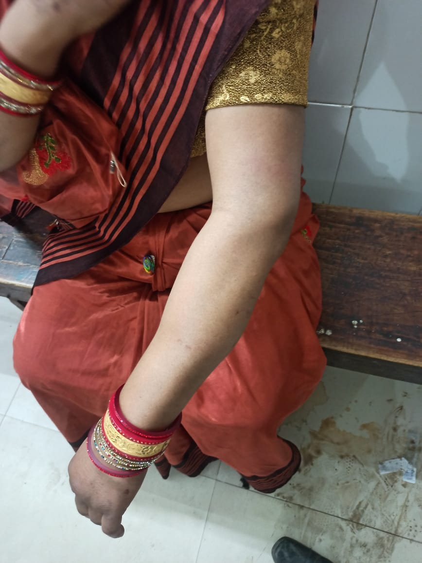 mitresh_rvem's tweet photo. जनपद ललितपुर में खुशी लाल चौबे के परिवार पर हमला हुआ है। कृपया @Uppolice @lalitpurpolice कार्यवाही कराएं। https://t.co/nclNAIunDB