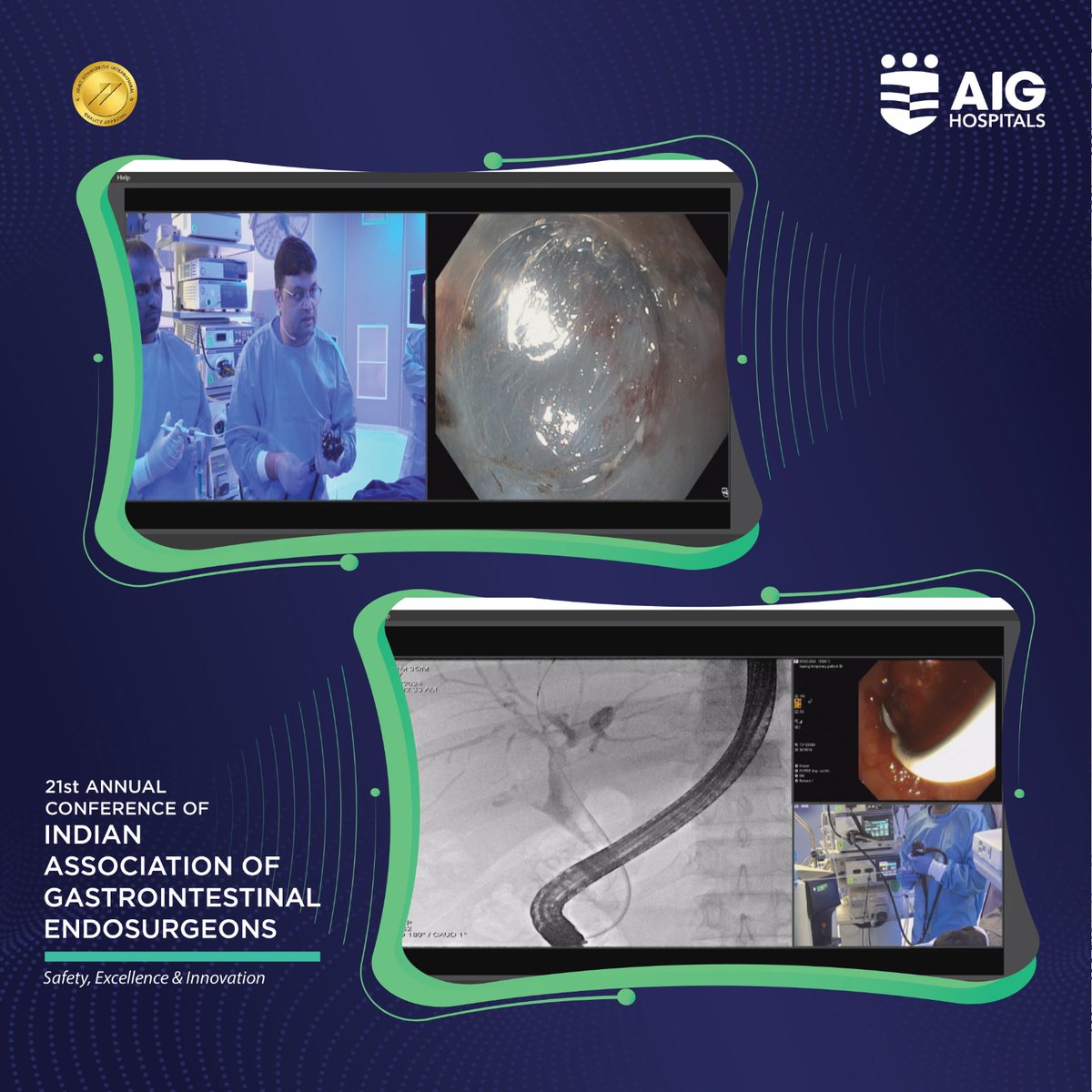 AIGHospitals's tweet image. LIVE Transmission of advanced endoscopic procedures from AIG Hospitals for the 21st Annual Conference of the Indian Association of Gastrointestinal Endosurgeons. #AIGHospitals #TherapeuticEndoscopy #ThirdSpace #EUS #ERCP #Conference
