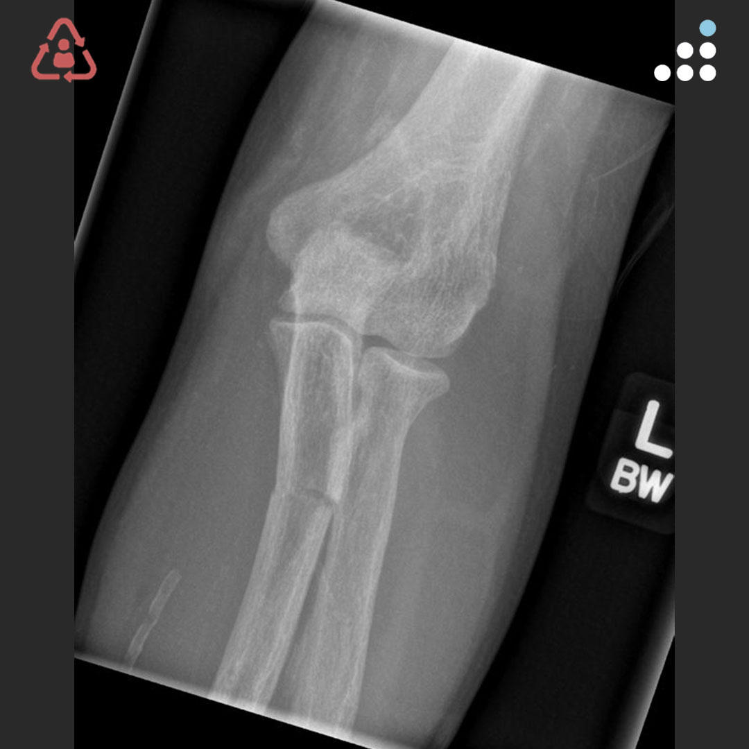 Orthobullets tweet media