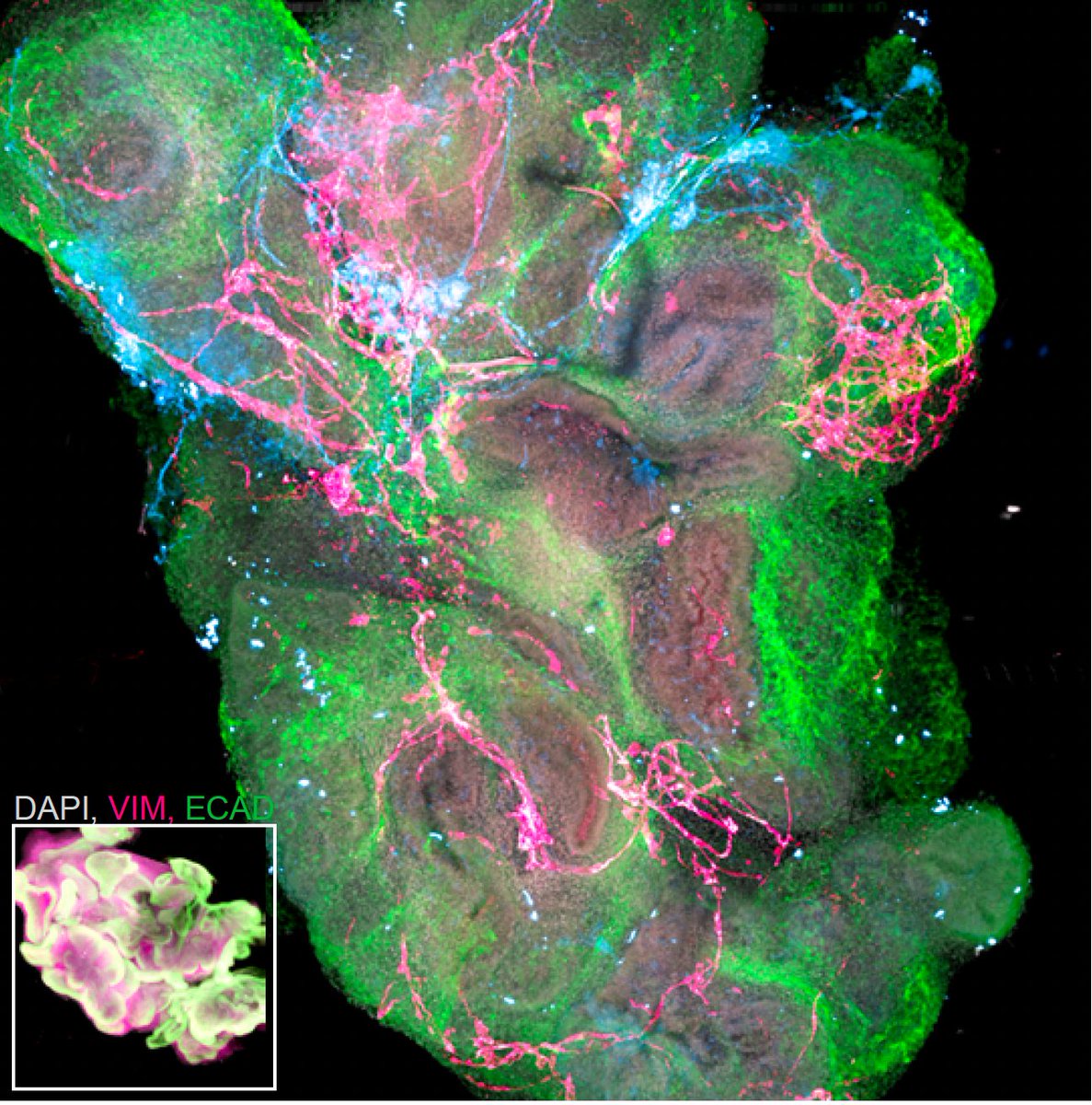 Charlie Childs (@c_j_childs) on Twitter photo I am in Boston for #SLAS2024! Please stop by my poster (Monday 2-3pm session, Poster # 1357-B) to check out how we are developing functional "mini-guts" for drug screening using stem cell-derived human intestinal organoid models. I am in Boston for #SLAS2024! Please stop by my poster (Monday 2-3pm session, Poster # 1357-B) to check out how we are developing functional "mini-guts" for drug screening using stem cell-derived human intestinal organoid models.