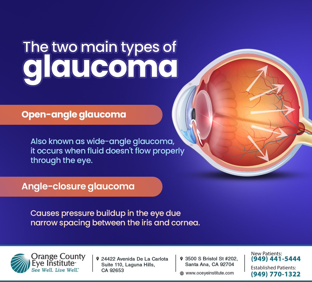 OCEyeInstitute's tweet image. Glaucoma can only be detected through an eye exam and early detection is vital to manage and treat this condition. Schedule an appointment at Orange County Eye Institute to learn about treatment options. #glaucoma #lagunahillseyedr