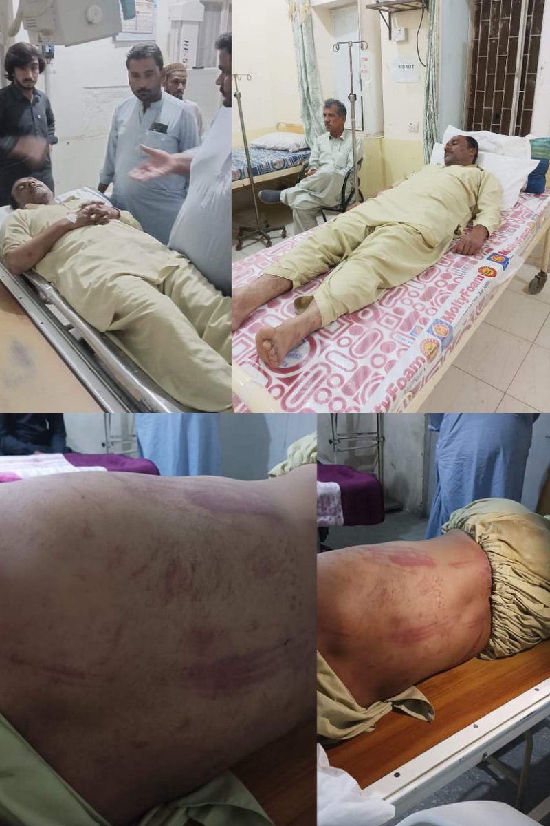 یعقوب جوسکی پر تشدد تربت انتظامیہ کی فرعونیت ہے ۔ جوکہ ناقابل برداشت ہے۔