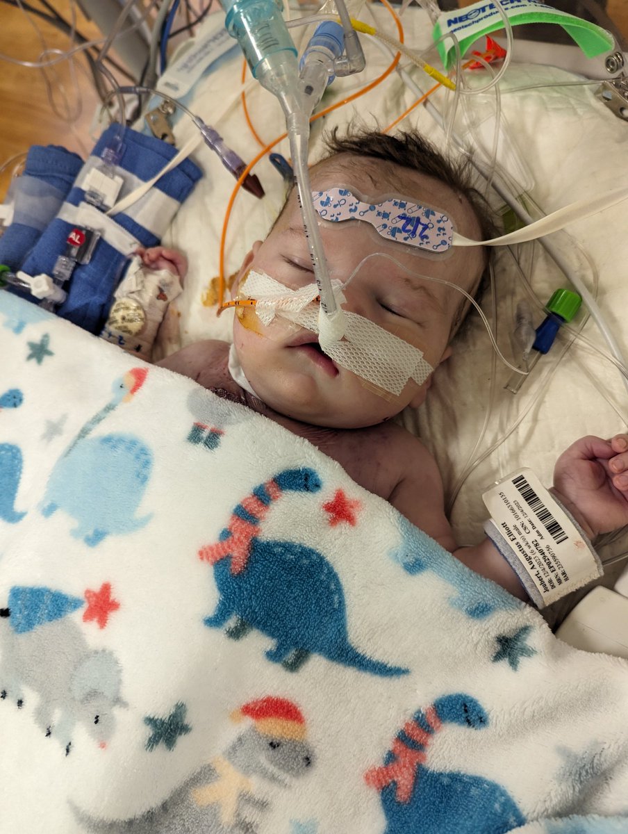 Hello friends. Gus is off ECMO support and stable. We are so thankful for this huge step, but we are also cautiously optimistic given how unpredictable Gus has been in the past! The goal is to keep him stable and slowly remove support. We're not out of the woods. Keep praying!