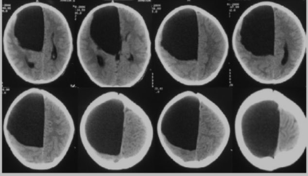 OGdukeneurosurg's tweet photo. This person has no neurological deficits. Explain? https://t.co/D9L2zOOFOh