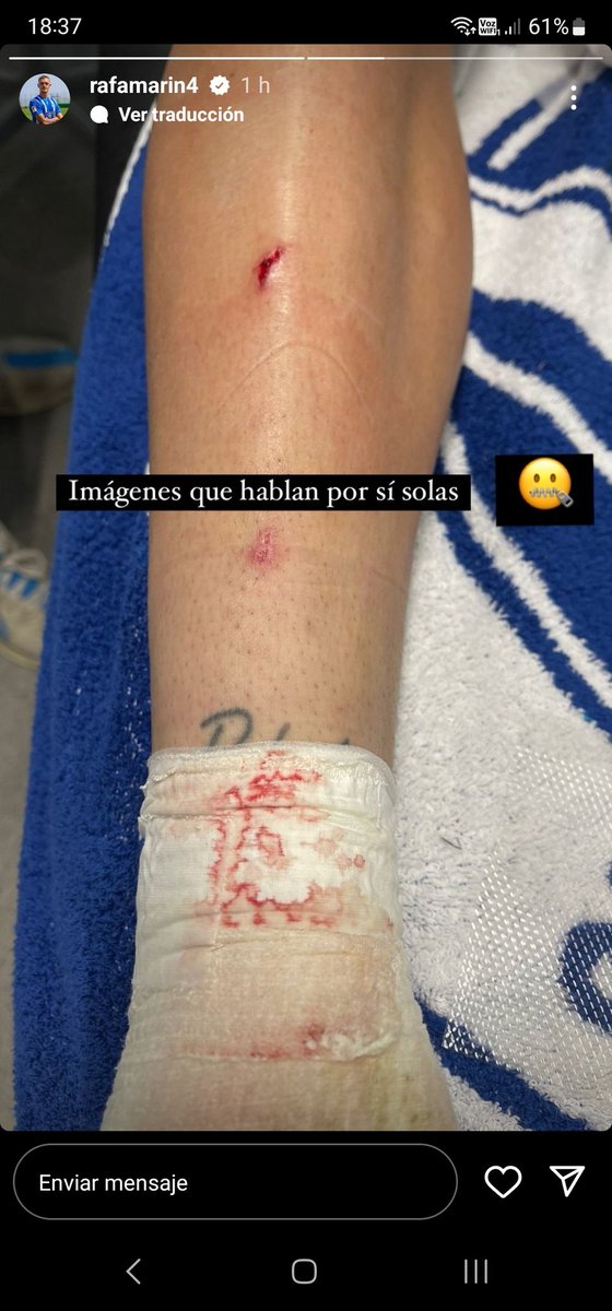 jota472's tweet photo. Que criminal entrada de Victor Roque, hasta le borro el tatuaje.  @cristobalsoria @jotajordi13 @CarmeBarcelo @elchiringuitotv @jpedrerol https://t.co/EDuMAvsWGT
