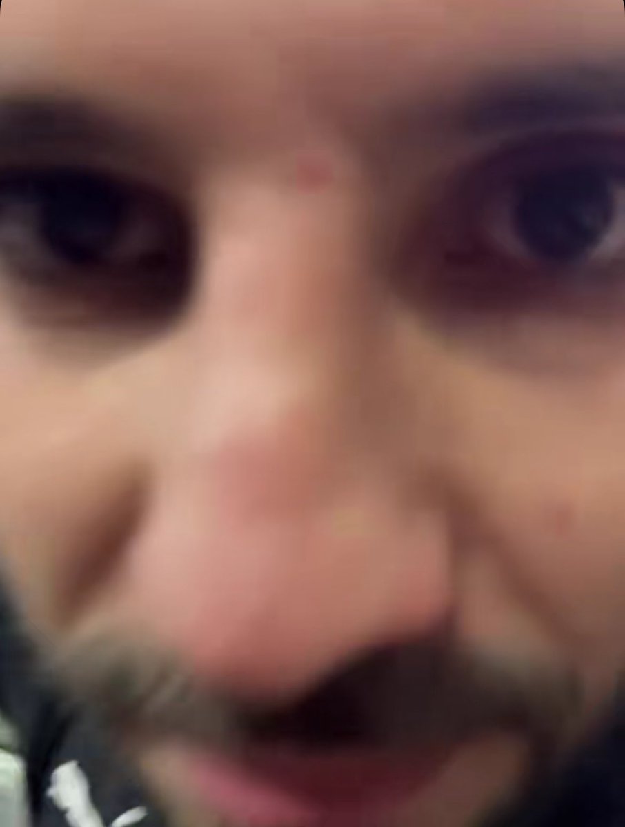 Ali Elnour . tweet media