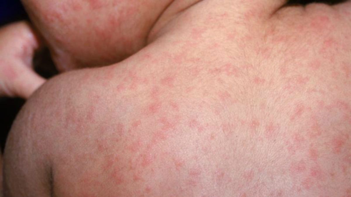 Kashif Pirzada, MD tweet media