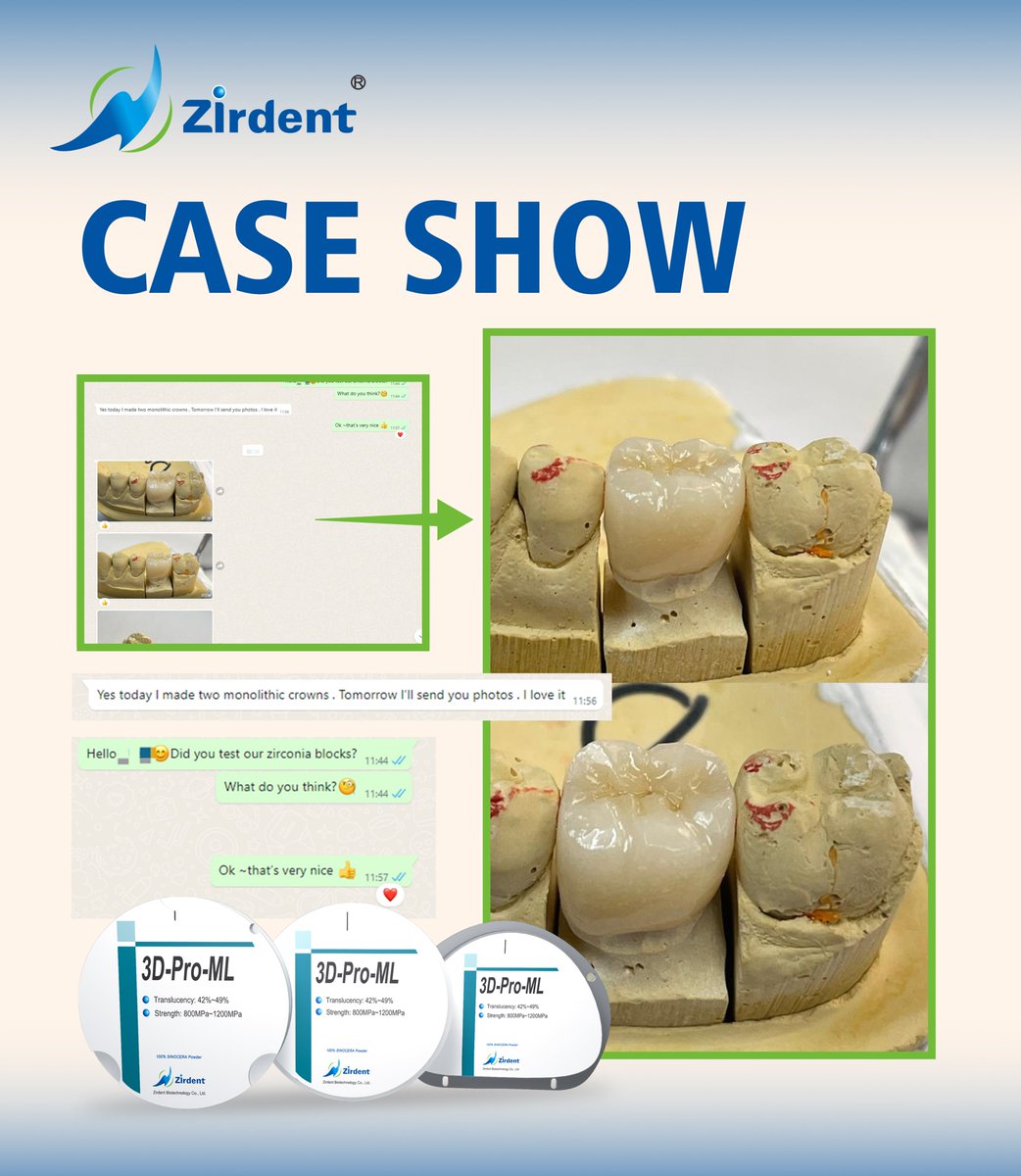 ZirdentO11896's tweet photo. 🔥Zirdent 3D-pro-ML case show
Contact us: https://t.co/loHZ6bGupw
#zirdent #caseshow #zirconia #dental #3DPro #zirconiadental https://t.co/hduxkndGM3