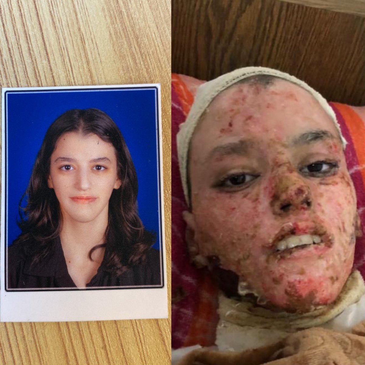 17.6 Billion to do more of this.