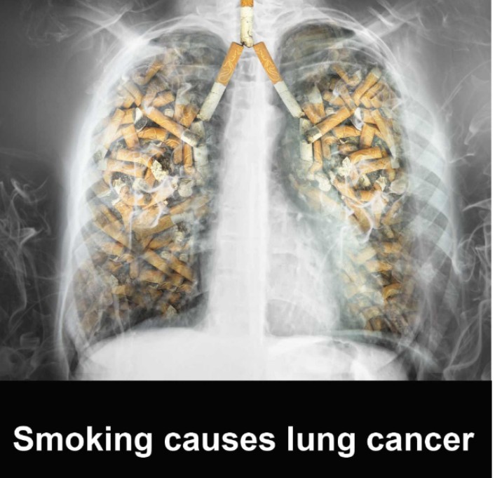 CHAITRA_VSV's tweet photo. समाज को सुन्दर स्वस्थ बनाना हैं!
कैंसर को भगाना हैं! 
Let's be Tobacco Free &amp; Cancer Free!
#TobaccoFreeFuture #CancerPrevention #WorldCancerDay  #TobaccoKills 
#TobaccoFreeCancerFree #BeatCancer #CancerFreeGeneration
#HealthForAll https://t.co/wjyOh9rybj