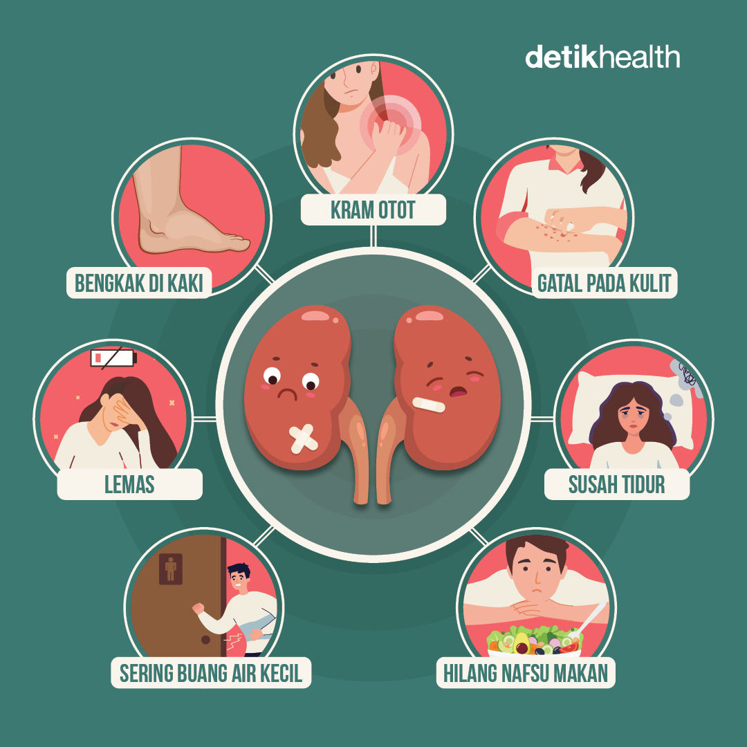 detikHealth's tweet photo. Ciri-ciri ginjal kotor sering tidak terdeteksi di awal. Salah satu alasannya adalah karena beberapa ciri tersebut mirip dengan kondisi umum lainnya, sehingga sering terabaikan.

Lantas, seperti apa saja ciri-ciri ginjal kotor tersebut? Simak di sini!

#detikhealth https://t.co/3PRftyBRdR