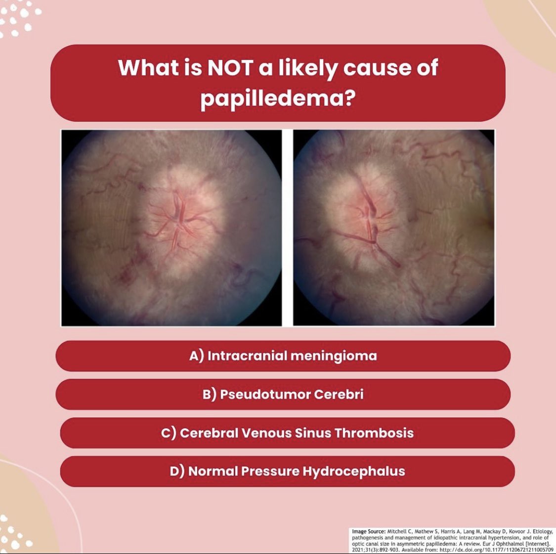 EyeCurriculum's tweet photo. No pressure…just another ophthalmology question of the week! 🤯

#ophthalmology #ophthalmologist #eye #eyehealth #med #medicine #medical #medstudent #medstudentlife #studygram #studynotes #medicalstudent #medicalstudents #medicalstudy #studymood #student https://t.co/eTElXutIQL