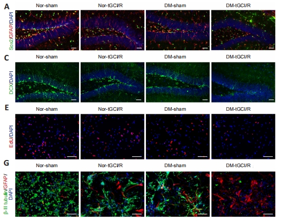 STMPUB's tweet photo. #postoperativecognitivedysfunction #smallextracellularvesicle #diabetes
Small extracellular vesicles secreted by induced pluripotent stem cell-derived mesenchymal stem cells improve postoperative cognitive dysfunction in mice with diabetes
https://t.co/QvD3zbmiul https://t.co/vg3svgCx8z