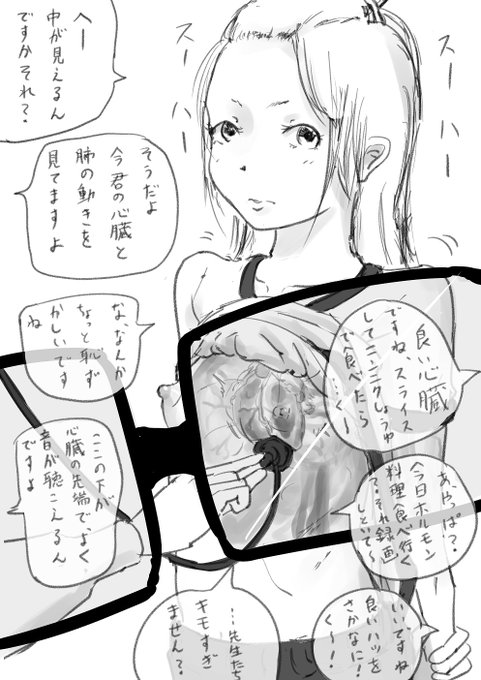 ç®ã®åã§èšºå¯ããŠããåã®å¿èãèŽã«ãã«ã¢ã³æçãé£ã¹ã«è¡ãç®æ®µããããã¢éããå
çé