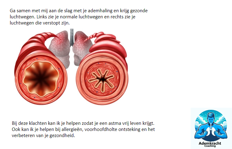 Geertademcoach's tweet photo. Zo zien gezonde en verstopte luchtwegen eruit. Dit zorgt voor een pijnlijke en piepende ademhaling waar ik vroeger veel last van had. Door aan de slag te gaan met mijn adem ben ik nu astma en allergie vrij. Dit kunnen we samen ook voor jou bereiken https://t.co/r3xG9XQa4T